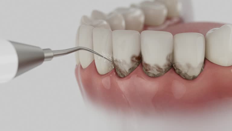 Reliable Dental Implants contractor in Homer Glen, IL by Smile Center Dentistry